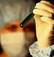 როგორ გავიკეთოთ ტესტი პარაზიტებზე